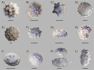 Palm Phytoliths of Mid-Elevation Andean Forests